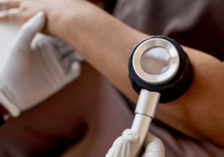 skin cancer screening