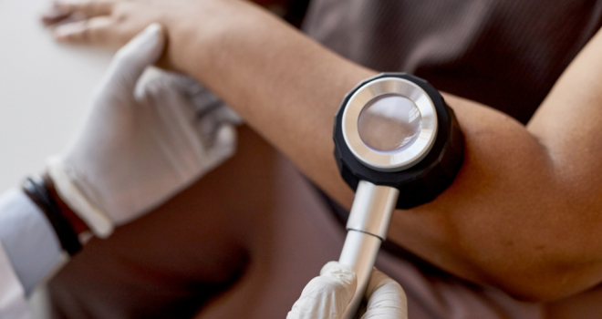 skin cancer screening